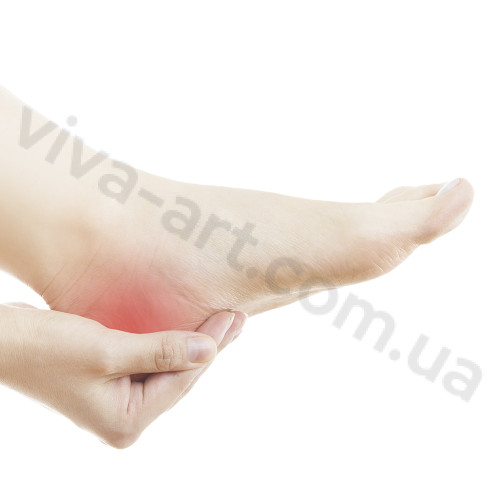 Подпяточник комфортный с мягкой латеральной зоной при пяточной шпоре, размер на выбор, пара.